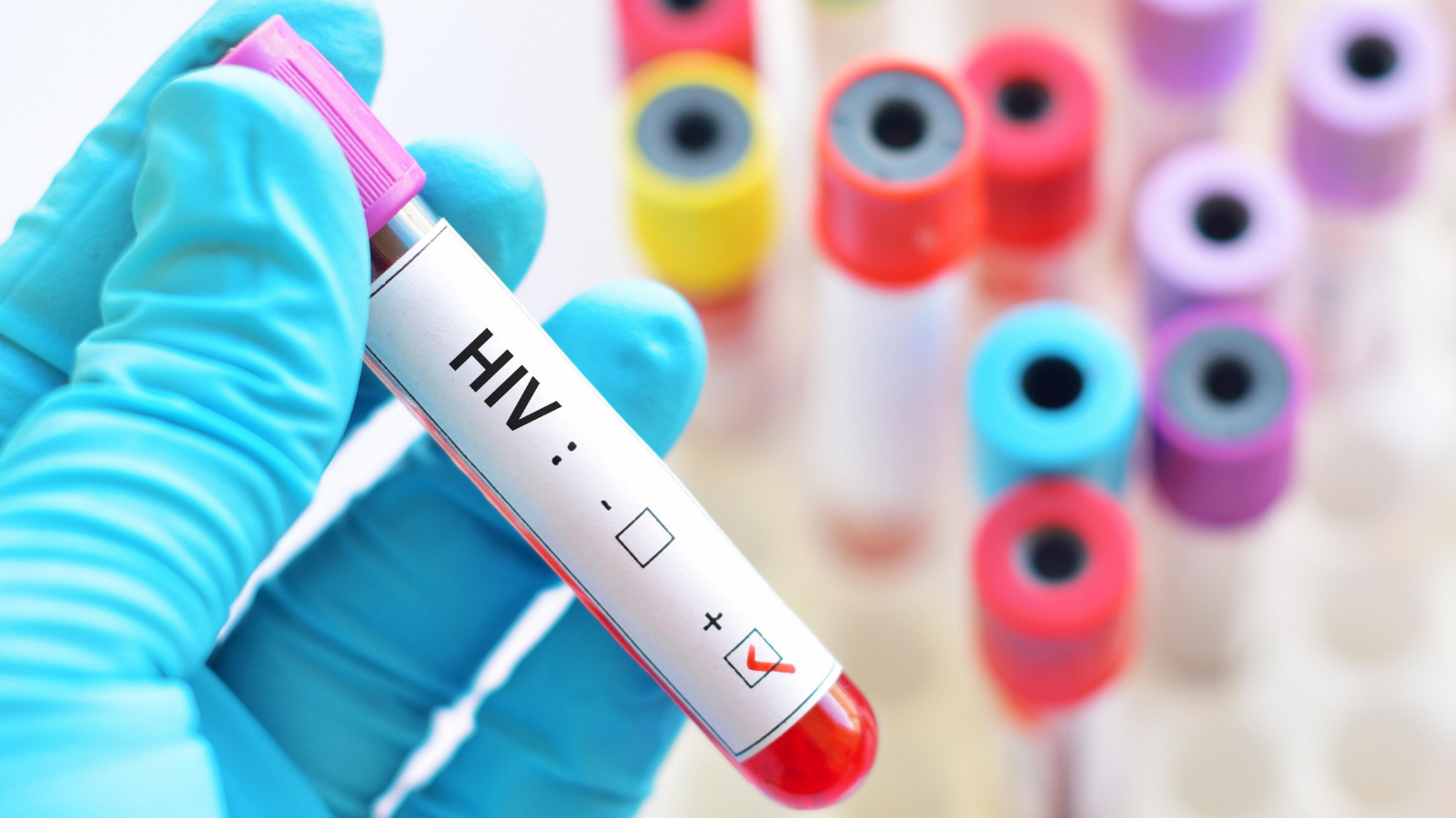 Infecciones de transmisión sexual siguen siendo un reto de salud pública en Colombia